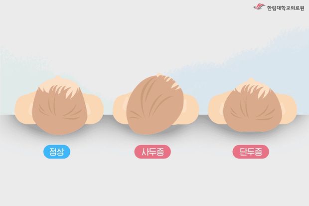 '300만원 헬멧'이 육아 필수템?… 하루종일 씌우는 부모들