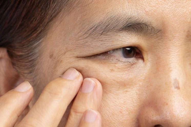 "며칠은 괜찮겠지"…2주 동안 '이것' 미루다 실명