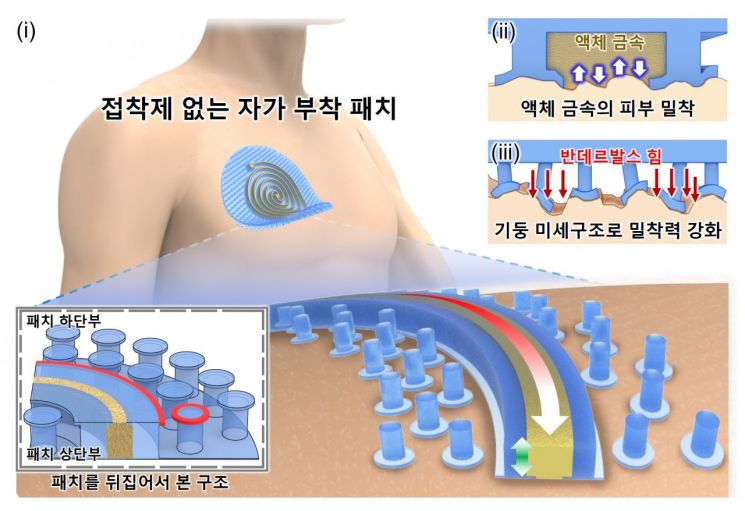 연구팀이 개발한 심전도 패치의 미세 구조.