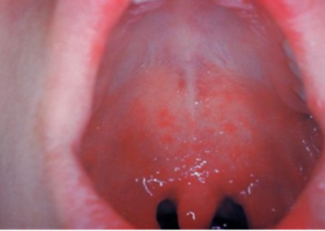 "이러다 3천명 넘는다" 상상초월 발병에…'후진국 되겠네' 싸늘한 민심