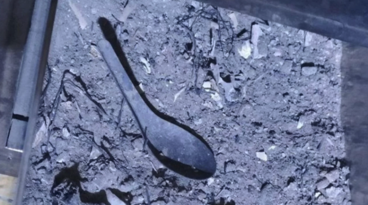 "심부전이라더니"…사망한 병사 유골에서 발견된 '섬뜩한 물체'