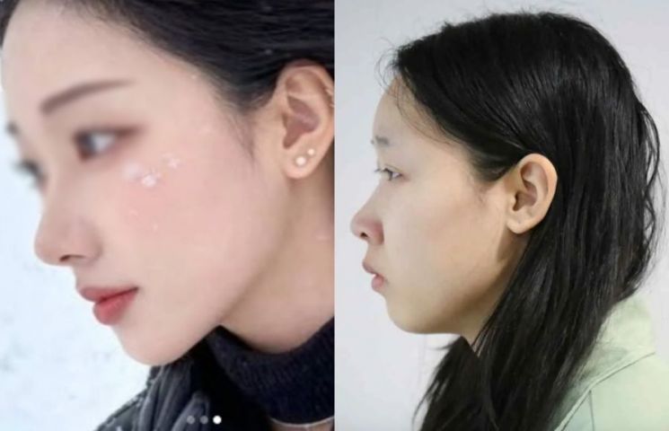 '강북 모텔 약물 사건' 피의자 김소영의 공개된 얼굴(오른쪽)과 김씨의 것으로 추정되는 SNS 계정 내 사진. 온라인 커뮤니티