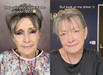 미국에서 70대 여성이 안면거상술을 통해 한층 젊어진 모습으로 변신해 화제다. 칼 트루스데일 틱톡 캡처