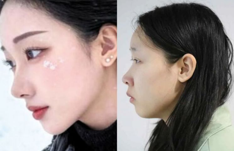 '강북 모텔 약물 사건' 피의자 김소영의 공개된 얼굴(오른쪽)과 그의 것으로 추정되는 SNS 계정 내 사진. SNS 캡처 ｜ 출처 : 아시아경제 ｜
