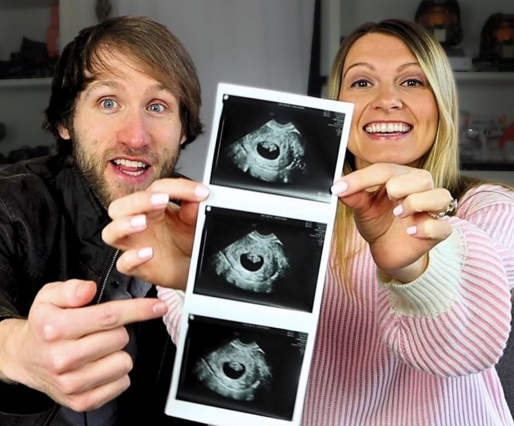 "You Tuber With 4. 3 Million Subscribers Admits to Pregnancy Termination After Down Syndrome Diagnosis, Sparks Heated Debate"