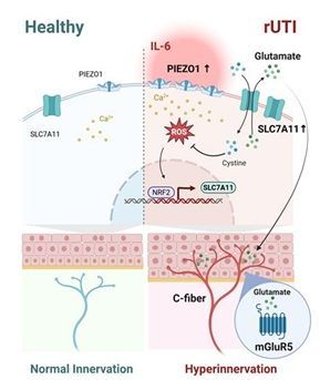반복 염증으로 압력 감지 단백질 피에조가 과도하게 늘어나면 세포 방어 과정에서 글루타메이트가 분비되고, 이 물질이 통증 신경을 자극해 새로운 신경 가지를 만들면서 만성 통증으로 이어진다. 연구팀 제공