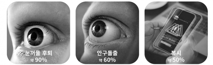 갑상선안병증의 주요 증상 및 경험 환자 비율.