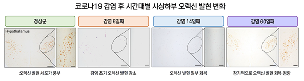 코로나19 감염 후 시간대별 시상하부 오렉신 발현 변화 추이. 국가독성과학연구소