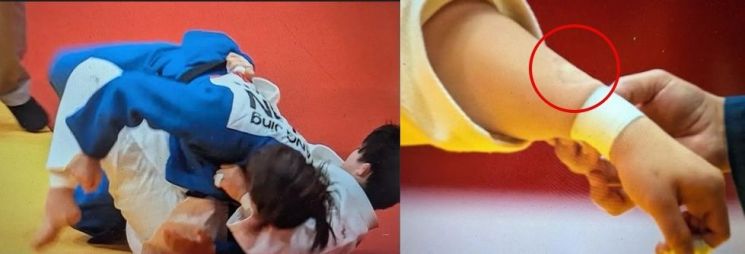 아시안게임 유도 경기에서 중국 선수가 상대 선수의 팔을 깨물어 반칙패를 당하는 이례적인 장면이 나왔다. SNS