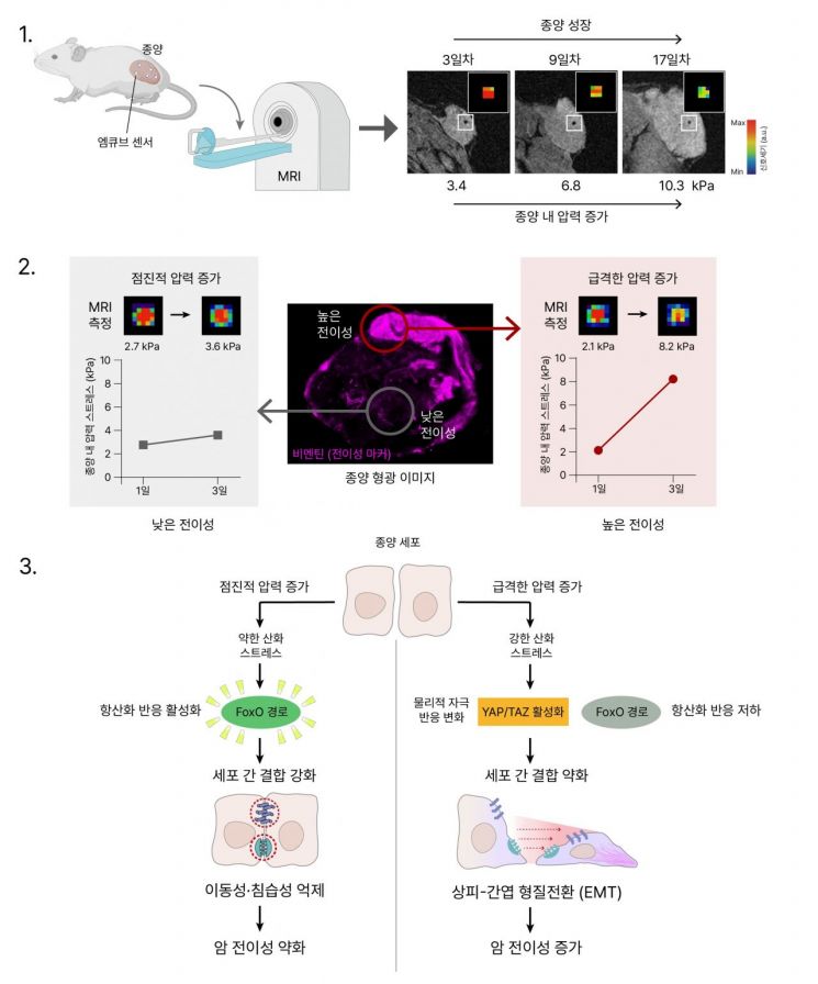 엠큐브 센서와 MRI를 이용해 살아있는 종양 내부의 압력 변화를 추적한 연구 결과. 암세포의 전이 성향이 높은 영역과 낮은 영역에서 서로 다른 압력 스트레스가 관측됐으며, 압력 변화가 암세포의 이동성과 침습성에 영향을 미치는 원리도 규명했다. 연구진 제공