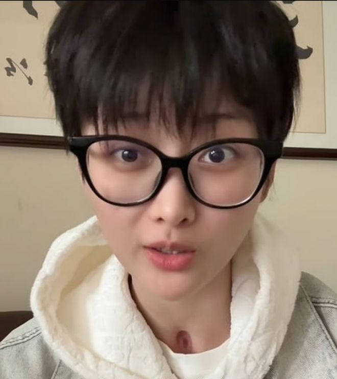 사고 이후 약 17개우러 만에 복귀 영상을 올린 중국 인플루언서 와나난. 중국 포털사이트 163.com 캡처