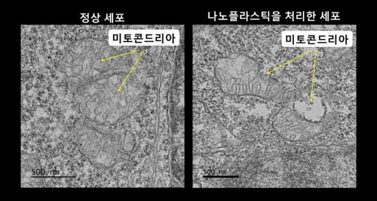 몸속에 들어온 미세 플라스틱, 세포를 공격한다?
