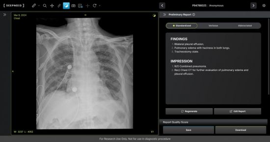 딥노이드, 생성형 AI 'M4CXR' 식약처 임상시험계획 승인
