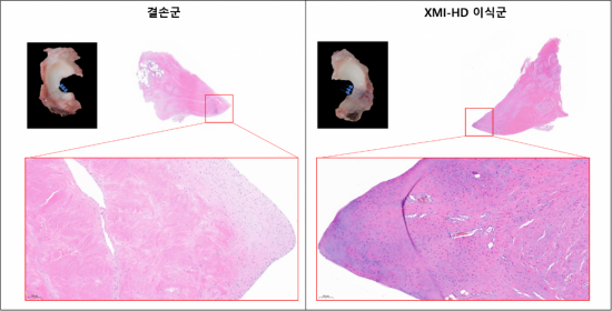 엠젠솔루션, 전임상서 생체조직 유래 반월상 연골판 이식재 안전성·유효성 확인
