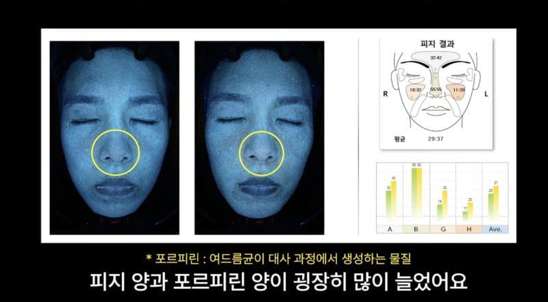 일주일간 고당·고지방 식단 설탕·정제 탄수·유제품만 섭취